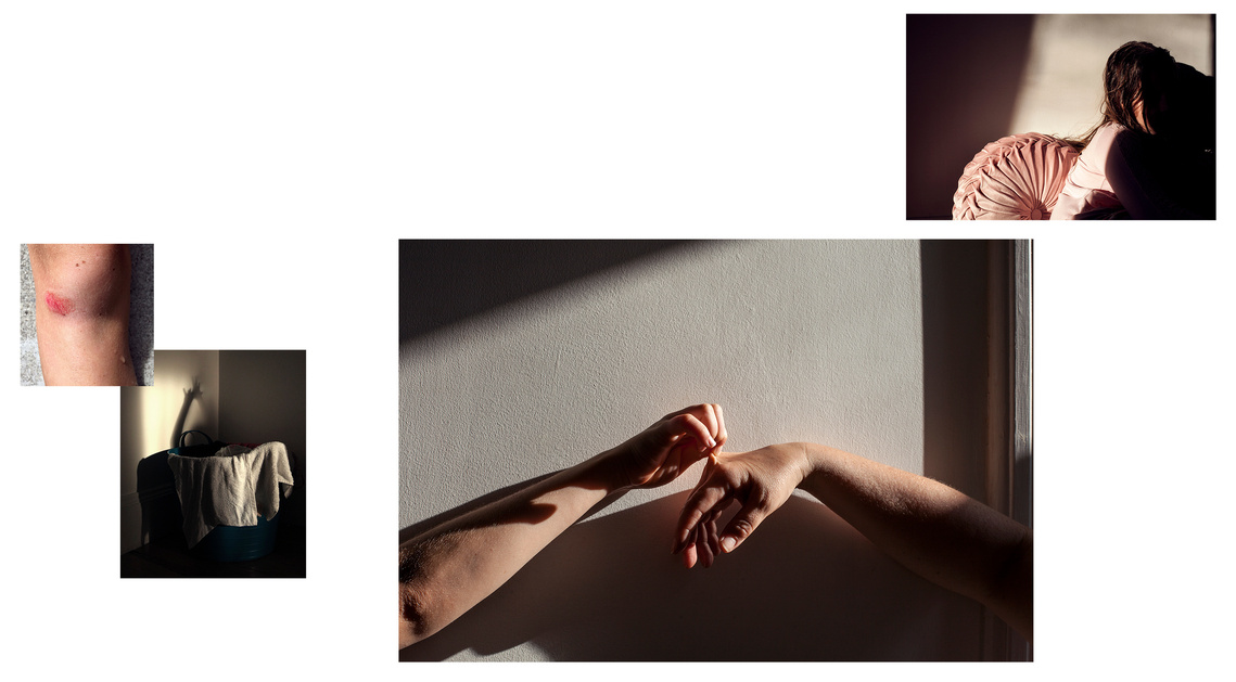 Jennifer Long, Caesura series, Feminist Photography Network, a skinned knee, child's shadow in laundry hamper, child's hand pulling the skin off a mothers, child in shadow