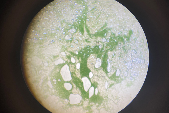 Spirulina Algae under the microscope