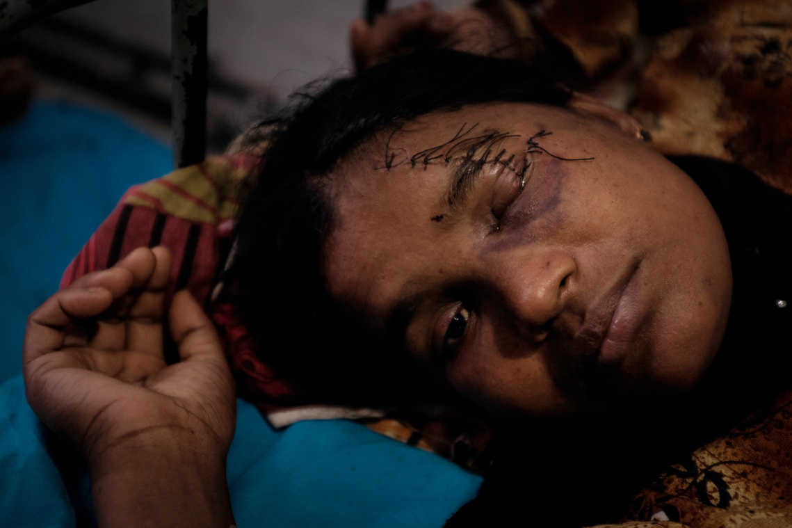 Rohingya trauma victim in hospital