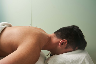 a patient during the acupuncture procedure