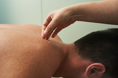 a hand putting a needle into patient's skin, acupuncture