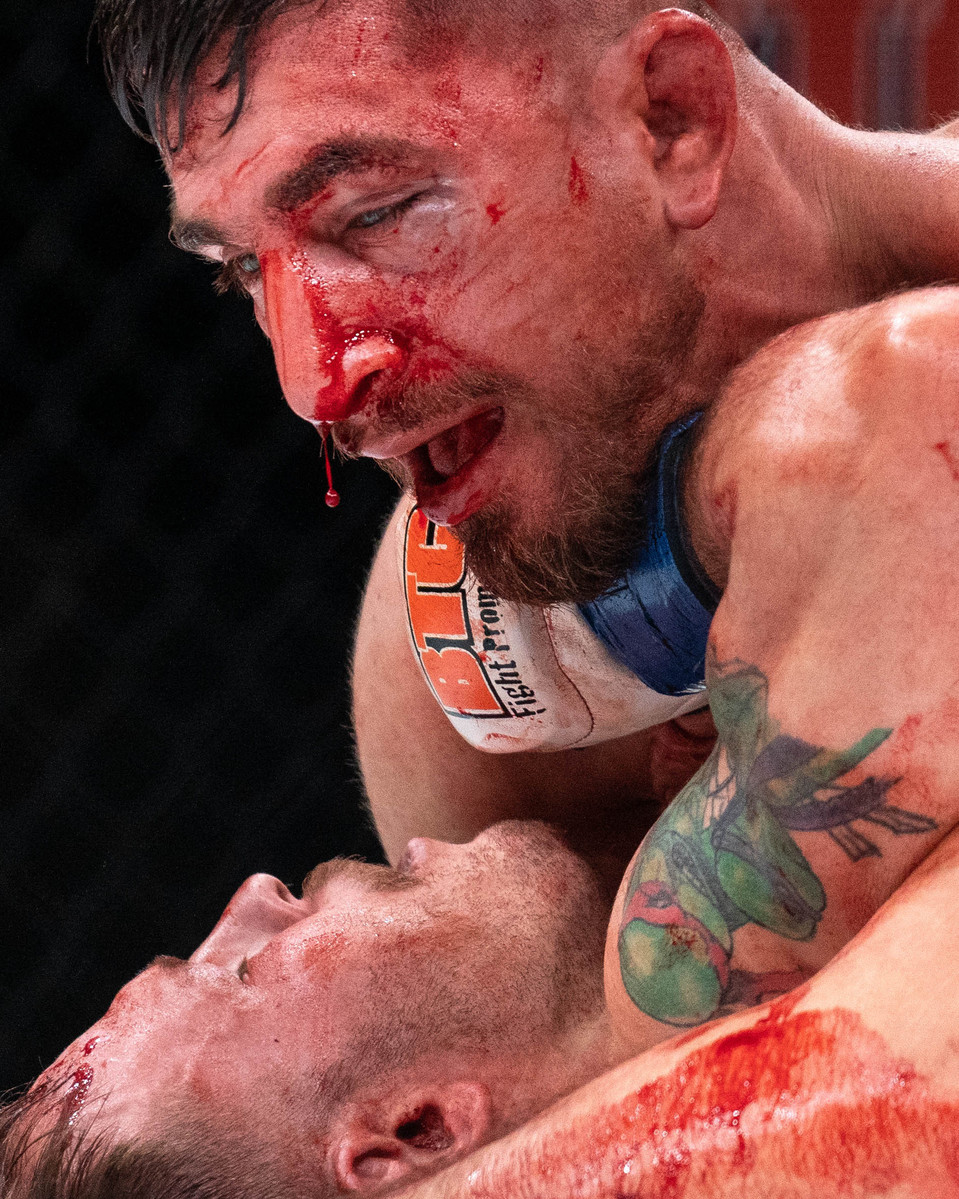 Blood drips from a man's nose during an MMA fight.