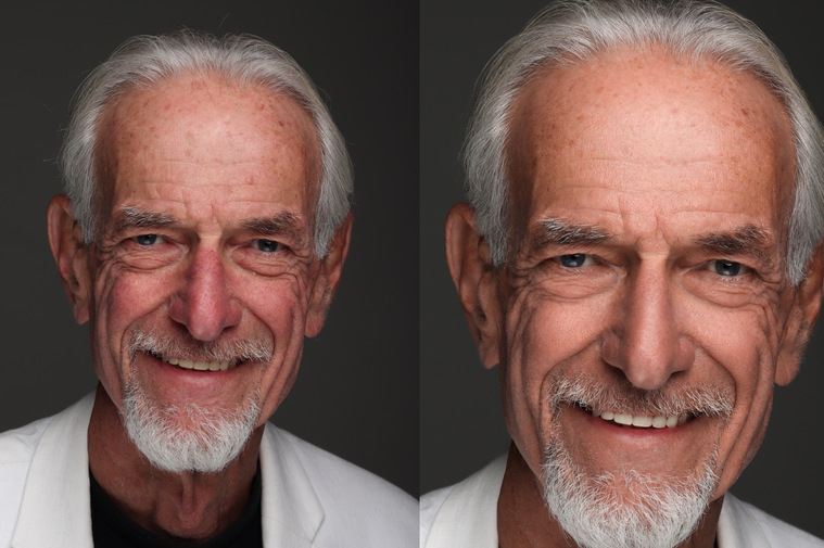 High End Retouching 