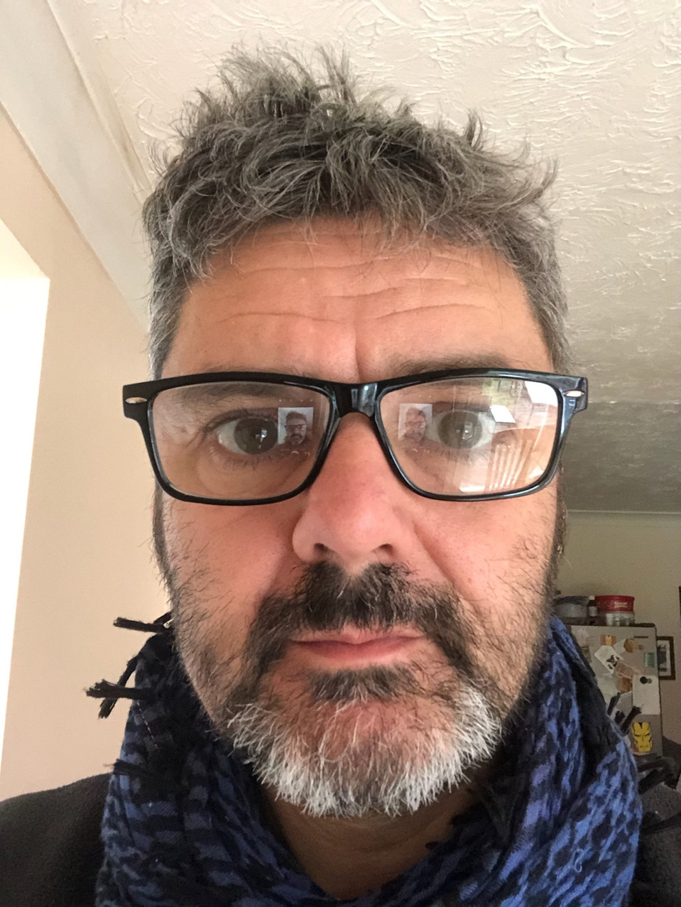 Camera phone, front camera, zero zoom - no ears and a stretched face.