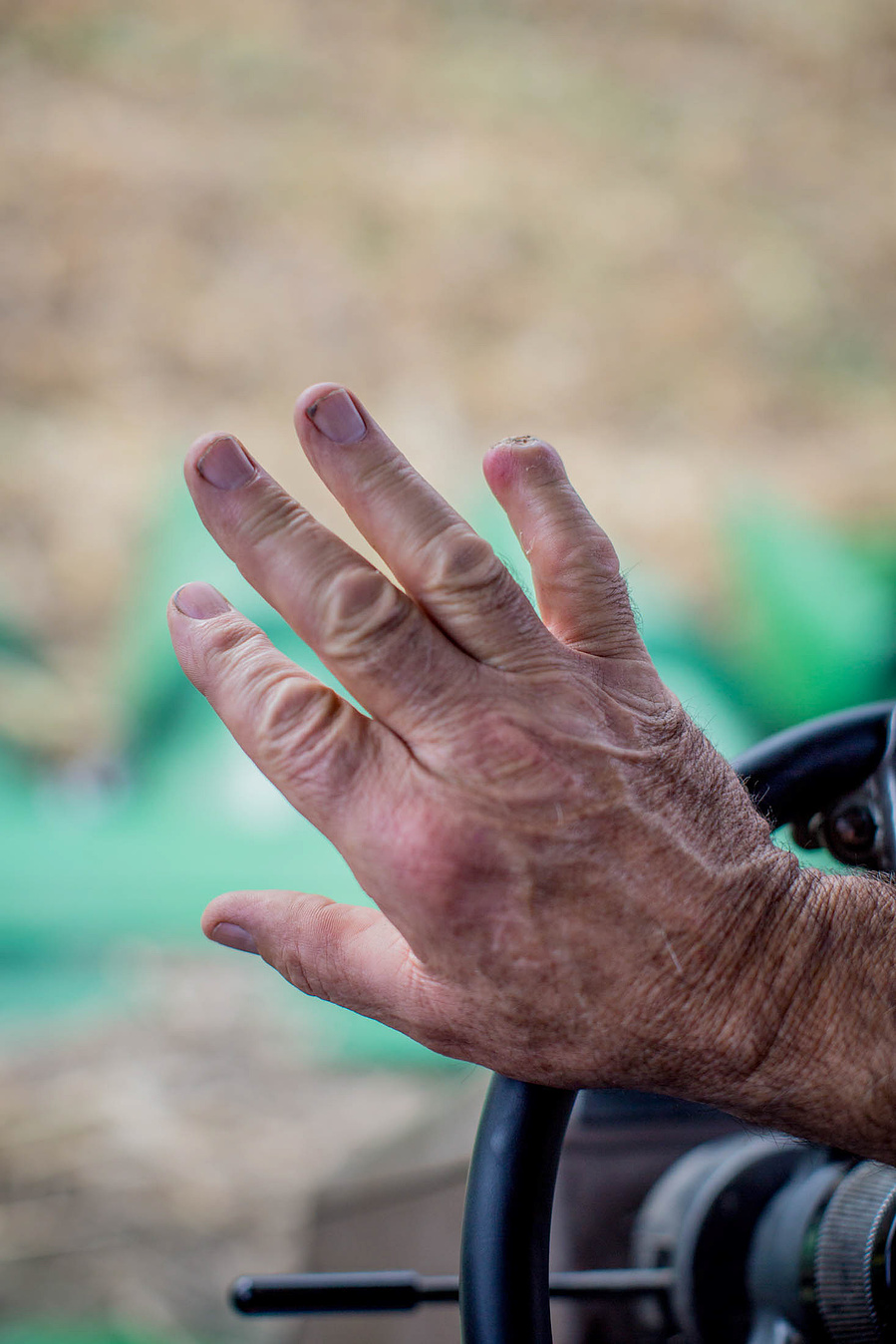 Dude is missing 1/2 of his pinky finger! 