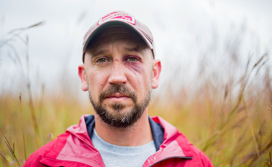 Oh no, Chris Klinge got a black eye. I wonder how it happened. I will ask him. 