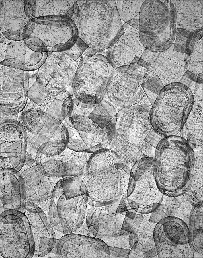 Arrangement of used hormone patches on a light box.