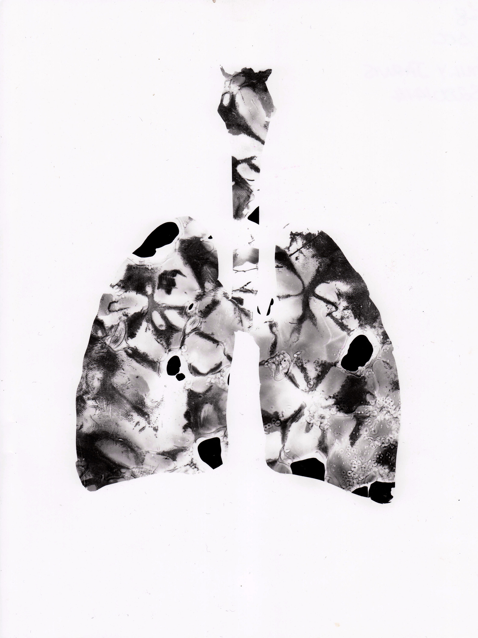 Smokey lungs