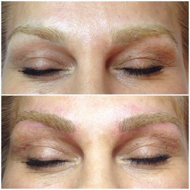 Brow tattoo cover up and correction.  BrowStyling microblading studio in Toronto