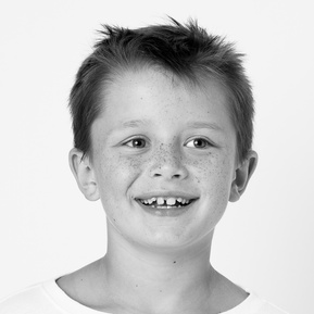 dark hair school boy with big smile showing his toothless grin in black and white