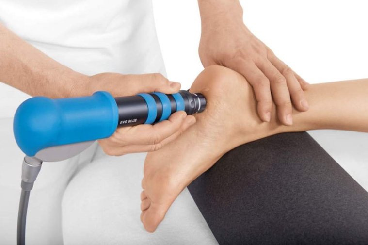 Radial Shock Wave Therapy