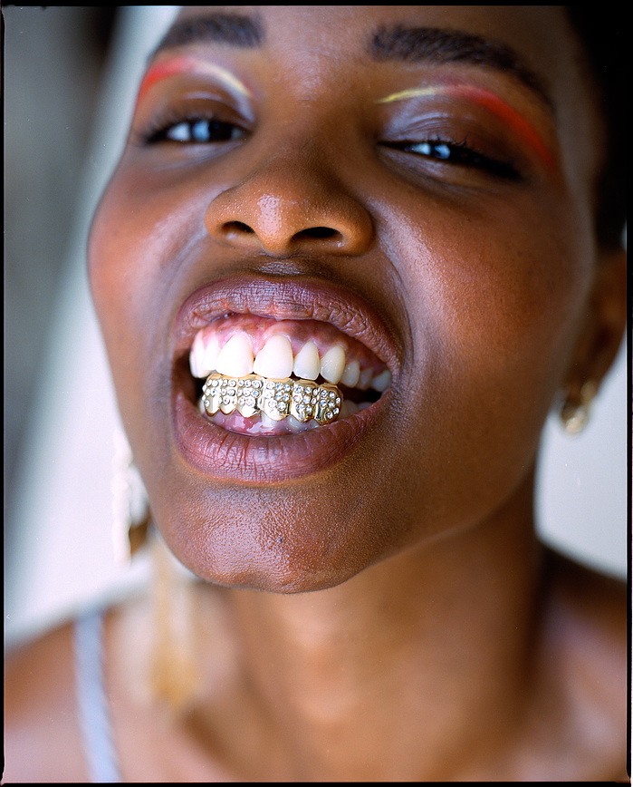Mireille close up on teeth grills