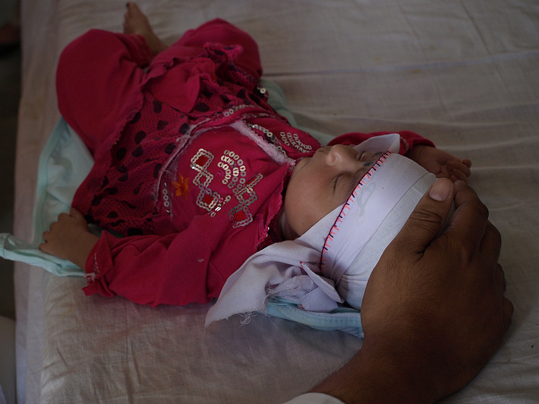 A baby wearing a bright pink outfit with pale pink headscarf lies asleep whilst being treated by Faisal Naqvi using cranial osteopathy. Osteopathic treatment using the cranial approach is gentle, safe and effective for babies and children. Nagar Valley.
