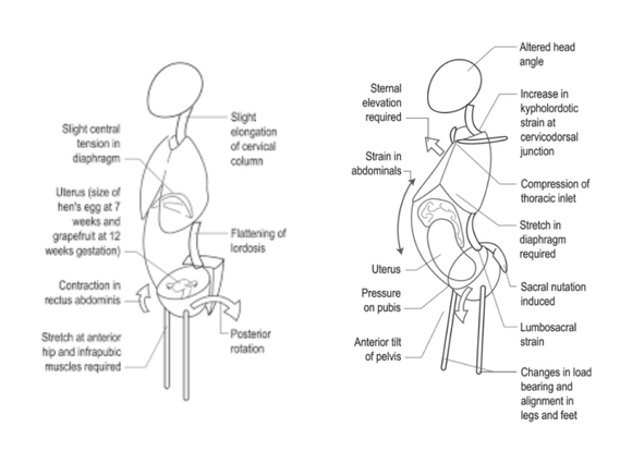 Schematic diagram illustrating the postural changes in anatomy from early to late pregnancy