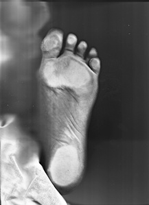An scanned image of a foot in black and white.