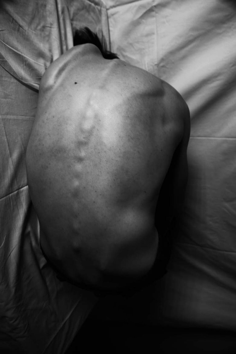 body photography in black and white | Hannah ostashver 