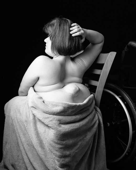 A black-and-white photo shows a seated, nude person with short hair facing away from the camera, their arm raised and hand touching their head. They are partially covered by a towel, with a visible wheelchair in the background.