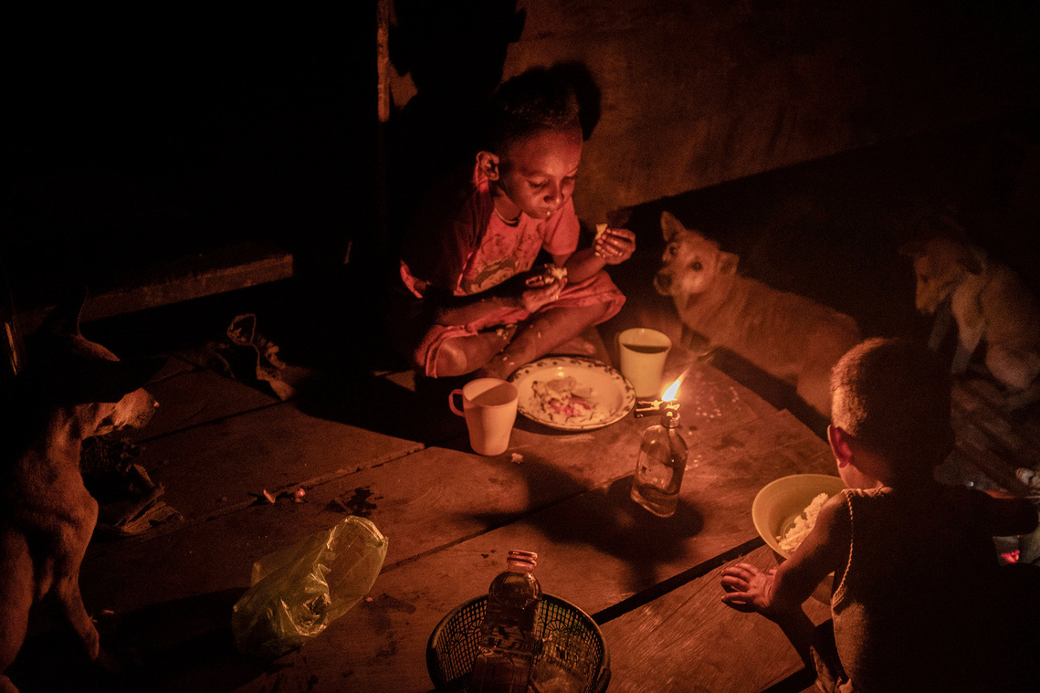 Merauke, Papua, Indonesia, 2019. Maliyaki Mahuze, 5, suffers from malnutrition. He was treated several times at the health service in their village. The number of cases of malnutrition in children has increased in deforested areas.