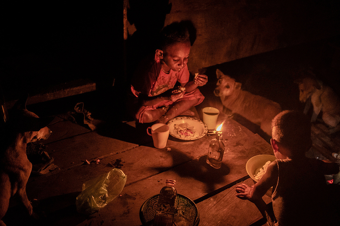 Merauke, Papua, Indonesia, 2019. Maliyaki Mahuze, 5, suffers from malnutrition. He was treated several times at the health service in their village. The number of cases of malnutrition in children has increased in deforested areas.