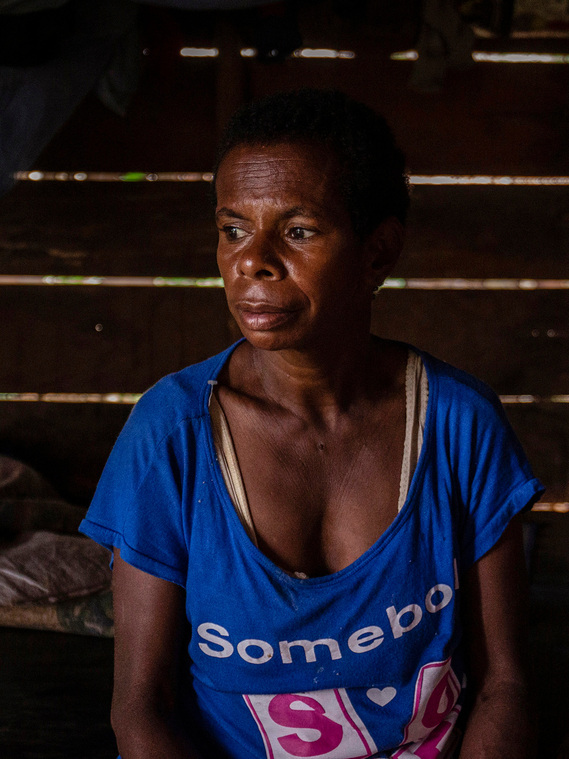 Boven Digul, Papua, Indonesia, 2019. Paskalina, 42, has had headaches for the past 2 years. She was stress. “There used to be a forest with lots of trees, it didn't feel hot. Now the forest is gone”, said her. Women have no voice to defend forest.