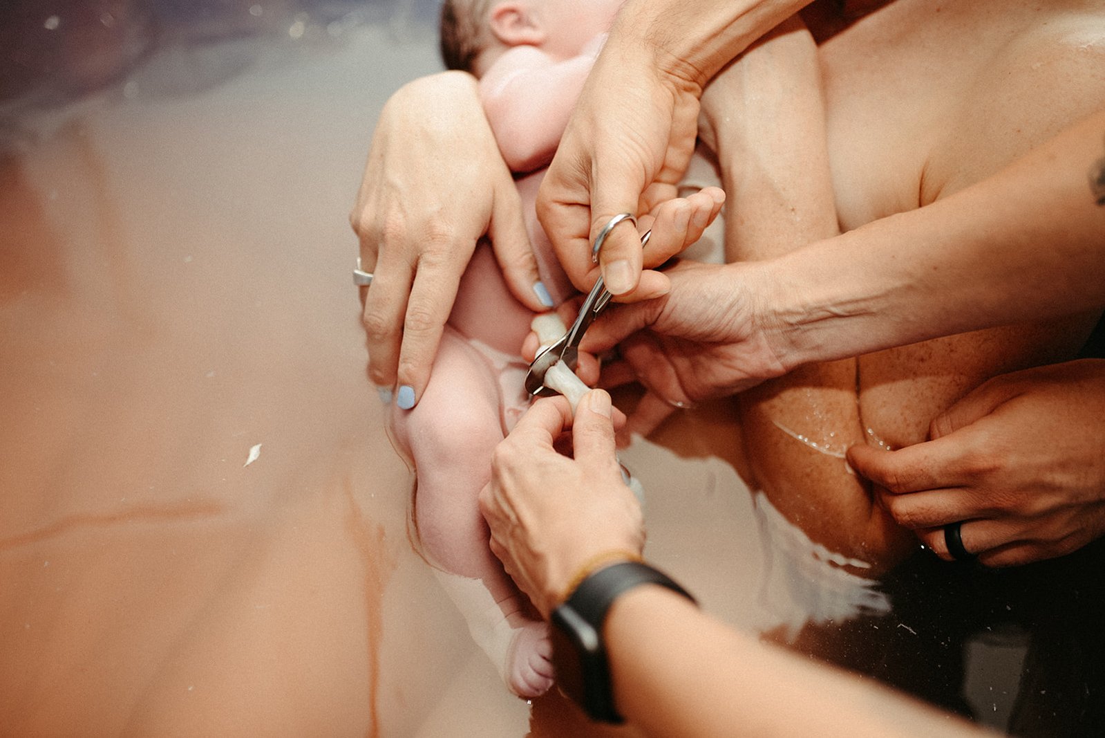 Cutting umbilical chord