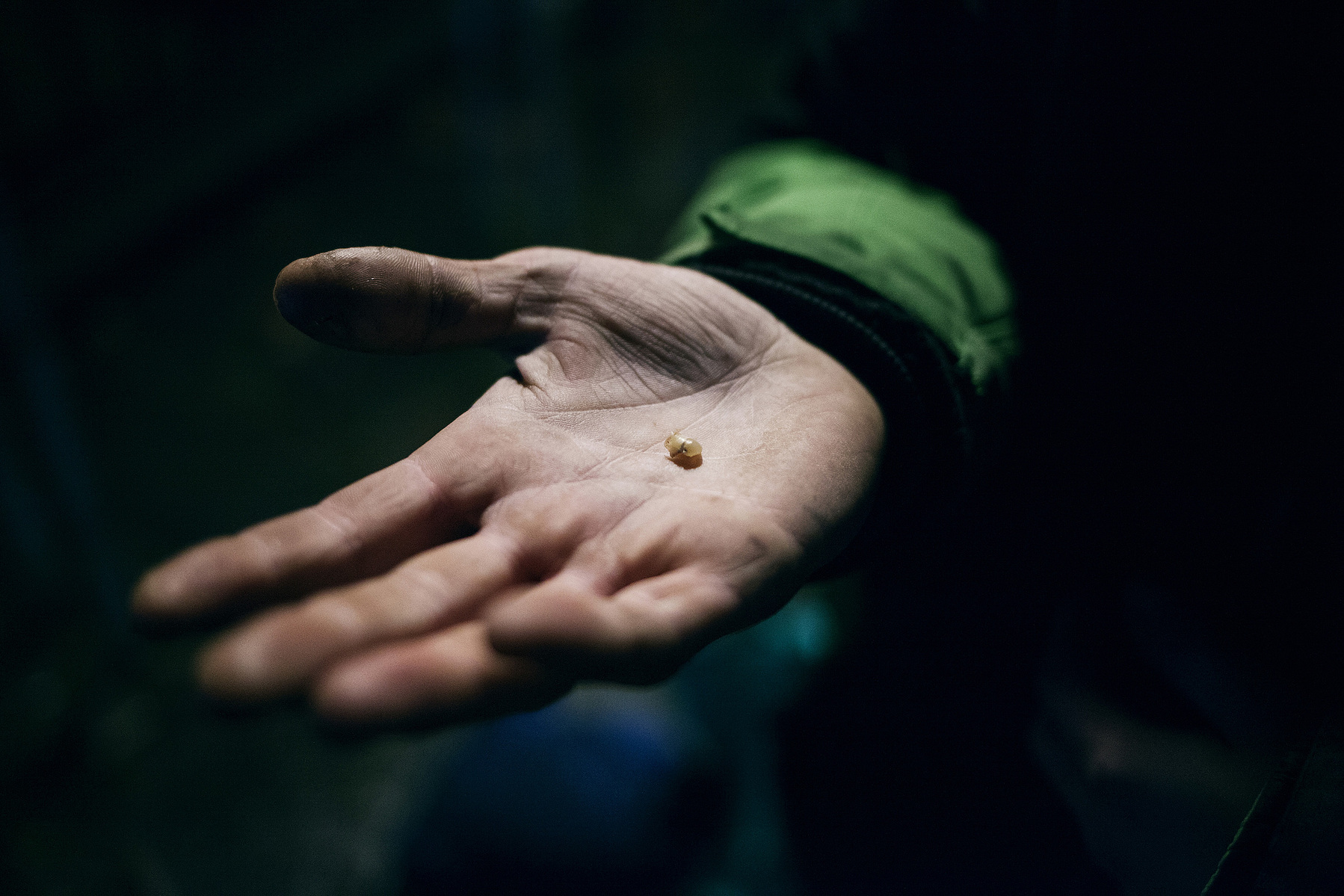 Martin pulls out one of his remaining 9 teeth. It scares him, that his teeth falls out without warning.