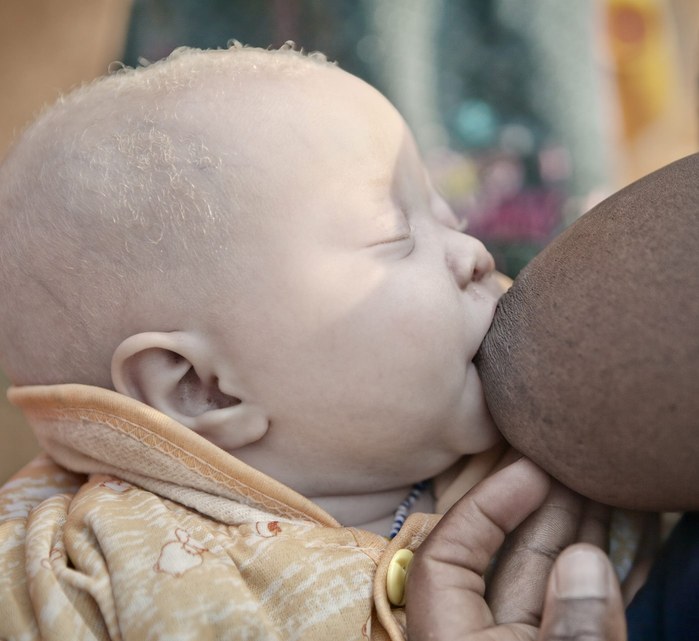 Albinos in Tanzania @ Ana Palacios Documentary Photographer