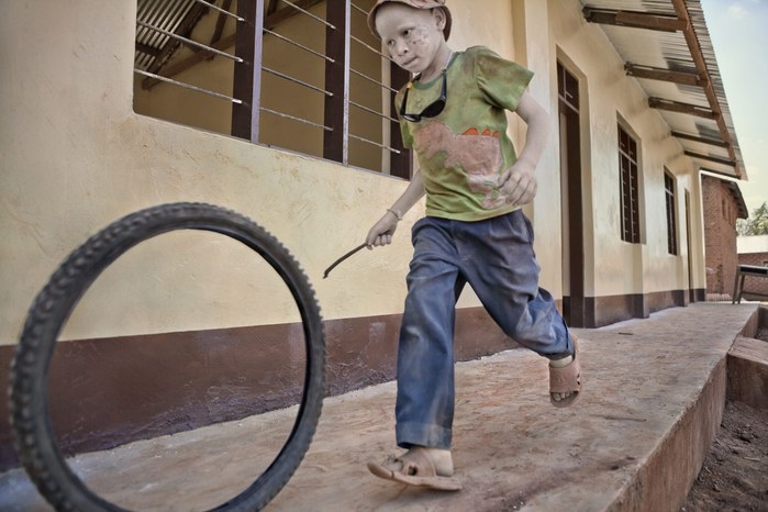 Albinos in Tanzania @ Ana Palacios Documentary Photographer
