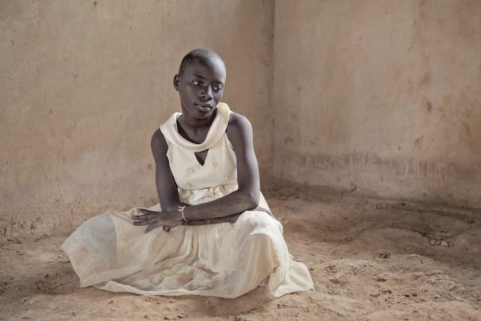 Albinos in Tanzania @ Ana Palacios Documentary Photographer