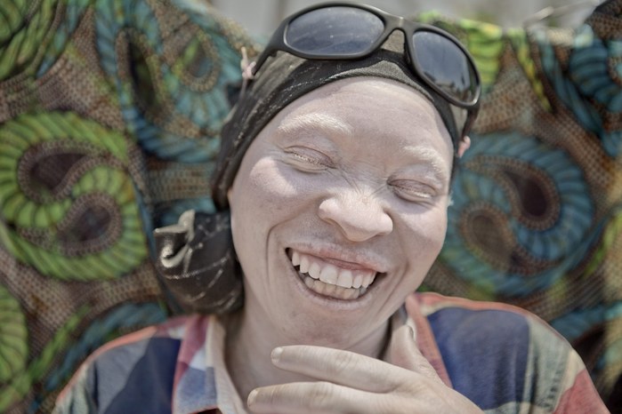 Albinos in Tanzania @ Ana Palacios Documentary Photographer
