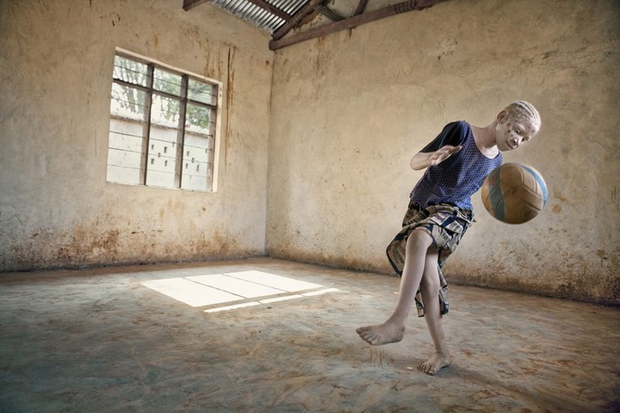 Albinos in Tanzania @ Ana Palacios Documentary Photographer