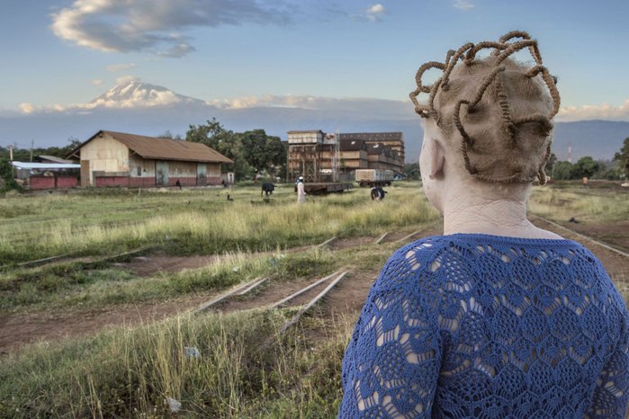 Albinos in Tanzania @ Ana Palacios Documentary Photographer