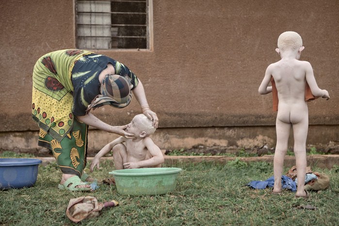 Albinos in Tanzania @ Ana Palacios Documentary Photographer