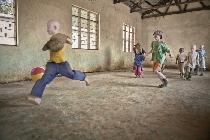 Albinos in Tanzania @ Ana Palacios Documentary Photographer