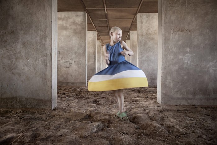 Albinos in Tanzania @ Ana Palacios Documentary Photographer