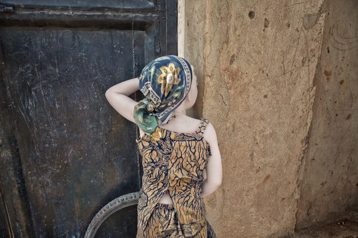 Albinos in Tanzania @ Ana Palacios Documentary Photographer