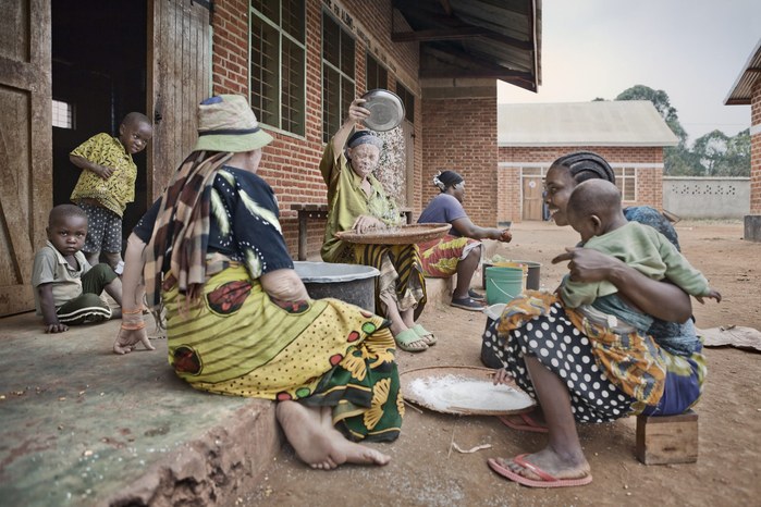 Albinos in Tanzania @ Ana Palacios Documentary Photographer