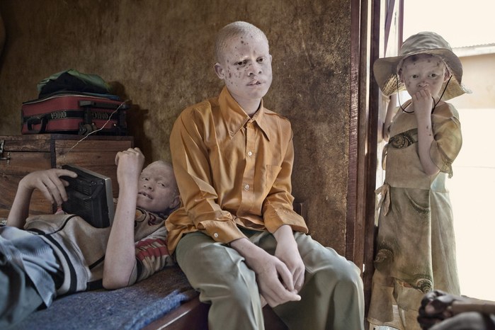 Albinos in Tanzania @ Ana Palacios Documentary Photographer