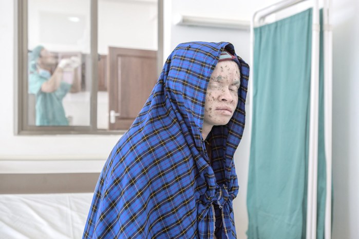 Albinos in Tanzania @ Ana Palacios Documentary Photographer