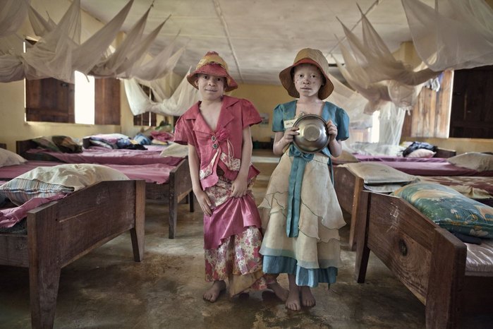 Albinos in Tanzania @ Ana Palacios Documentary Photographer