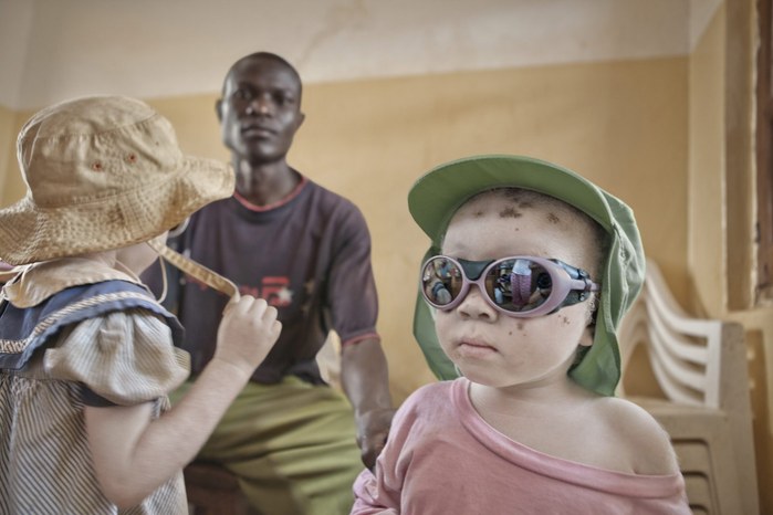 Albinos in Tanzania @ Ana Palacios Documentary Photographer