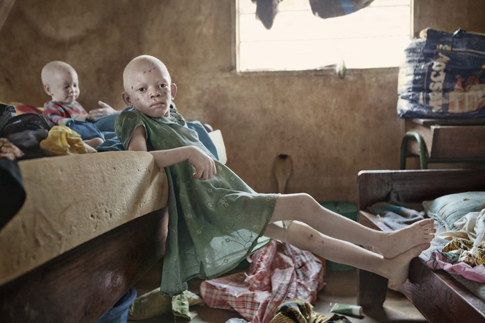 Albinos in Tanzania @ Ana Palacios Documentary Photographer