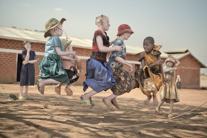 Albinos in Tanzania @ Ana Palacios Documentary Photographer