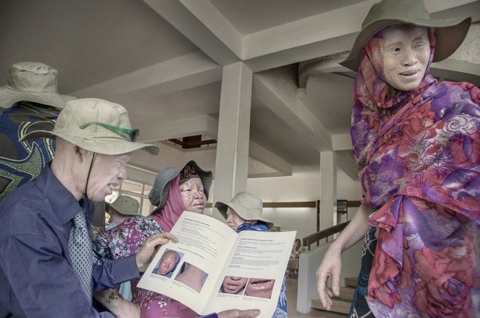 Albinos in Tanzania @ Ana Palacios Documentary Photographer