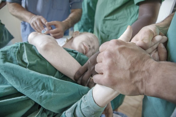 Albinos in Tanzania @ Ana Palacios Documentary Photographer