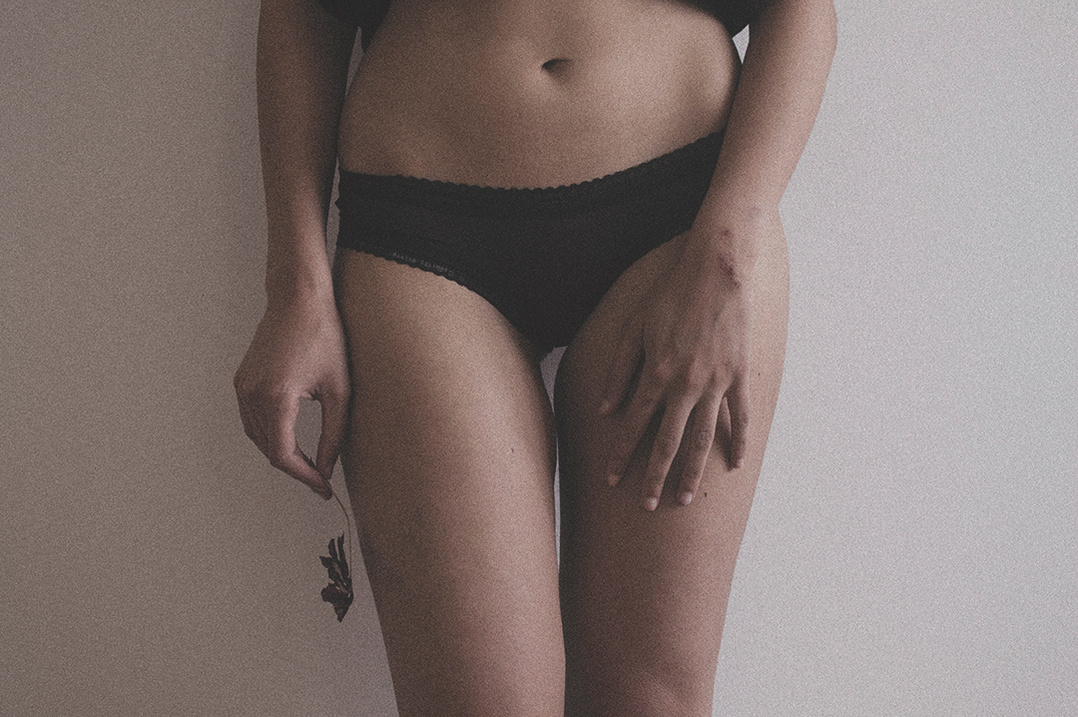 Soft self portrait of young woman with bruises on her skin