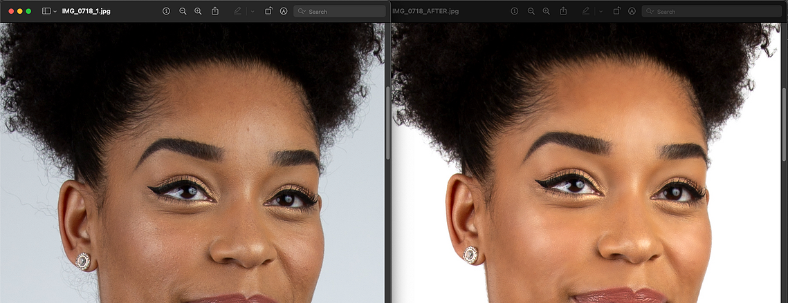 Skin Smoothing