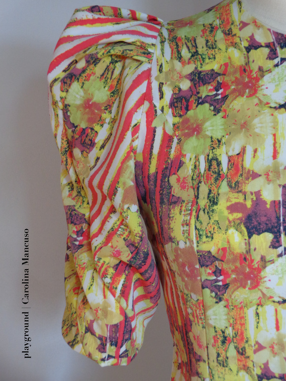 draped sleeve TR technique