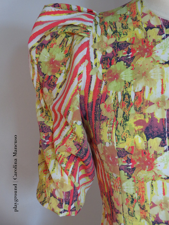 draped sleeve TR technique